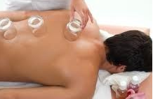 Cupping Therapy