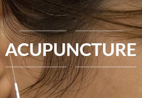 Acupuncture