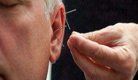 Health Acupuncture's Goal