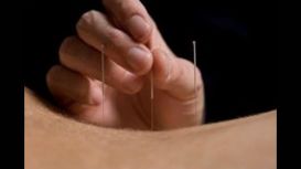 The Acupuncture Community Clinic